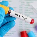 PSA test